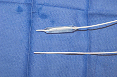 Two medical wires on blue surgical drape.