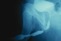 X-ray image of a human knee joint.