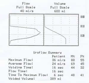 Flow-Scale-Comparison-300x279