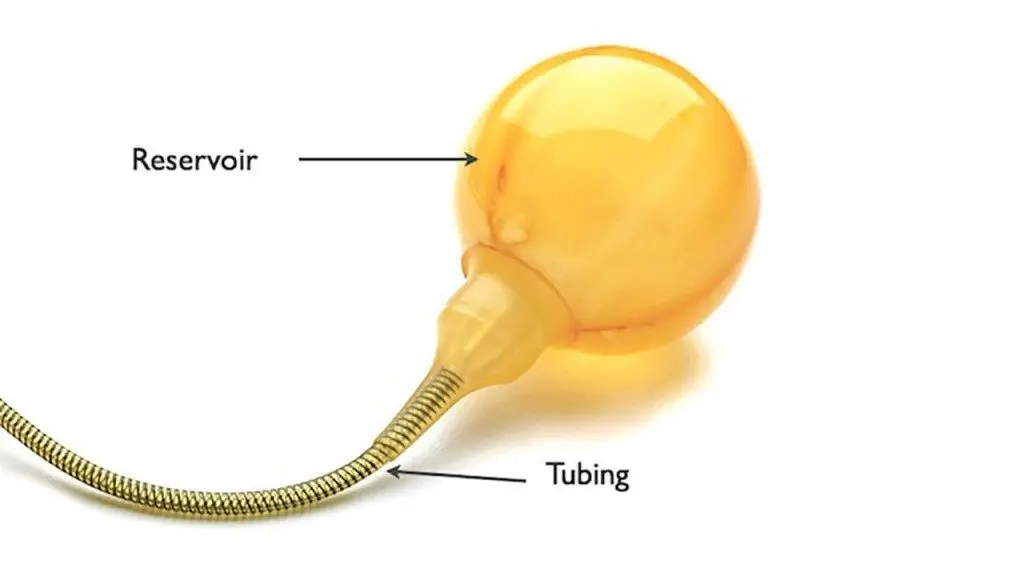 Penile Implant Reservoir Image With Labeling Section