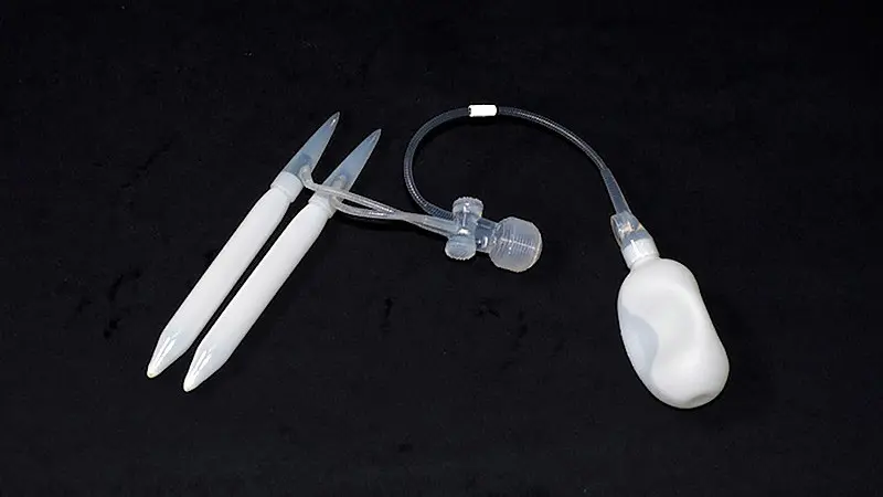 “Titan” Inflatable Penile Implant – Prosthesis manufactured by Coloplast, cylinders inflated


